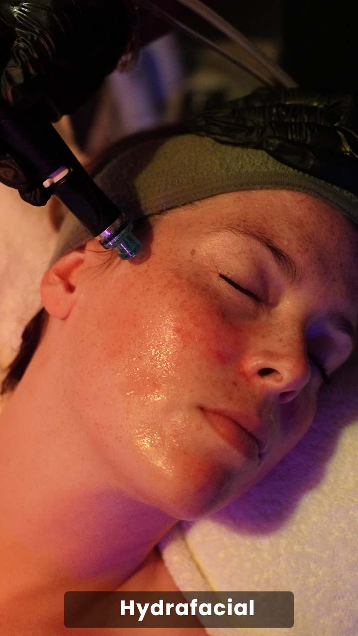 Cras tristique purus non lacus