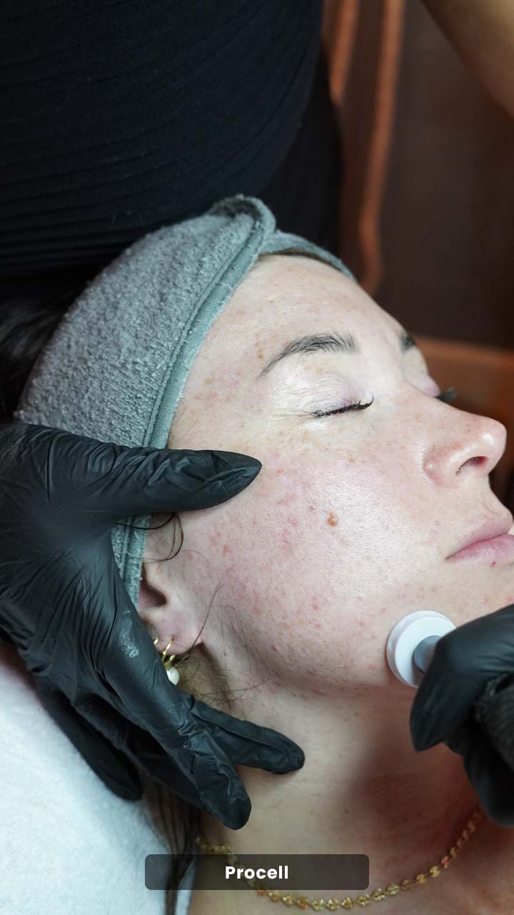 Cras tristique purus non lacus